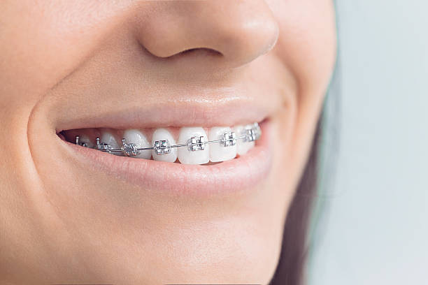 Why Choose Us for Your Dental Needs in Pion Hills, CA